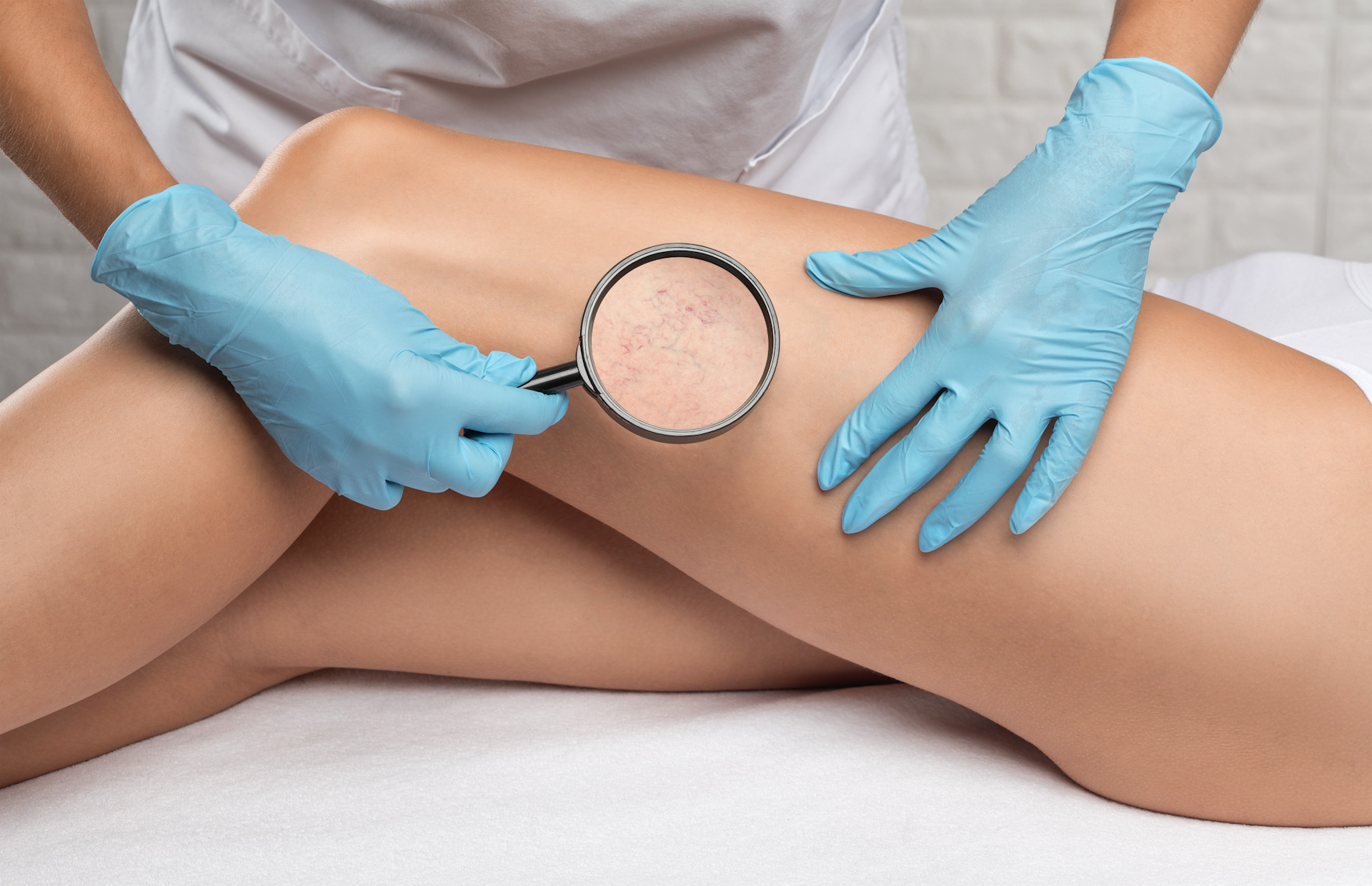 venous-disease